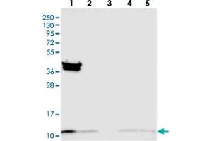 Western blot analysis of Lane 1: RT-4, Lane 2: U-251 MG, Lane 3: Human Plasma, Lane 4: Liver, Lane 5: Tonsil with TIMM10 polyclonal antibody  at 1:250-1:500 dilution.