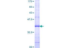 Image no. 1 for Pyrimidinergic Receptor P2Y, G-Protein Coupled, 6 (P2RY6) (AA 1-102) protein (GST tag) (ABIN1313829)