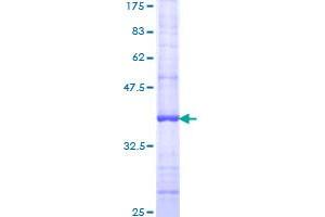 P2RY6 Protein (AA 1-102) (GST tag)