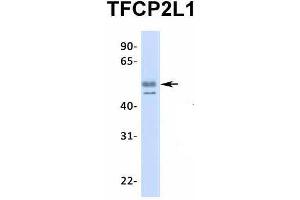 Host:  Rabbit  Target Name:  TFCP2L1  Sample Type:  Human Fetal Heart  Antibody Dilution:  1.