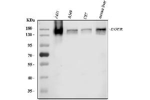 Western blot analysis of EGFR using anti-EGFR antibody (ABIN3044518).