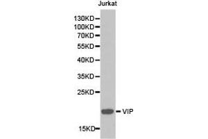 Western blot analysis of extracts of Jurkat cell lines, using VIP antibody. (Vip antibody)