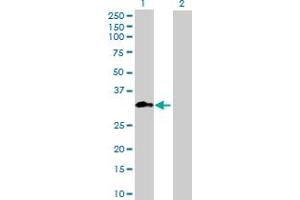 Western Blot analysis of METTL1 expression in transfected 293T cell line ( H00004234-T01 ) by METTL1 MaxPab polyclonal antibody. (METTL1 antibody  (AA 1-276))