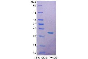 SDS-PAGE (SDS) image for Growth Differentiation Factor 9 (GDF9) (AA 306-440) protein (His tag) (ABIN2125114) (GDF9 Protein (AA 306-440) (His tag))