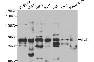 Western Blotting (WB) image for anti-Atlastin GTPase 1 (ATL1) antibody (ABIN1876490)