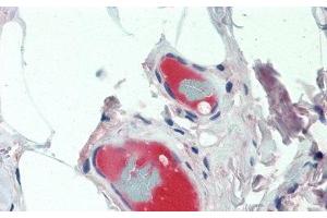 Detection of CP in Human Small Intestine Tissue using Monoclonal Antibody to Ceruloplasmin (CP) (Ceruloplasmin antibody  (AA 789-1065))