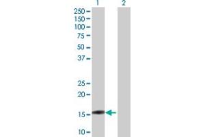 Western Blot analysis of BIRC5 expression in transfected 293T cell line by BIRC5 MaxPab polyclonal antibody.