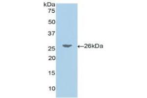 Western blot analysis of recombinant Human JAG1. (JAG1 antibody  (AA 33-250))