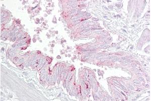 Immunohistochemistry with Lung, respiratory epithelium tissue at an antibody concentration of 5µg/ml using anti-PA2G4 antibody (ARP47601_P050) (PA2G4 antibody  (C-Term))