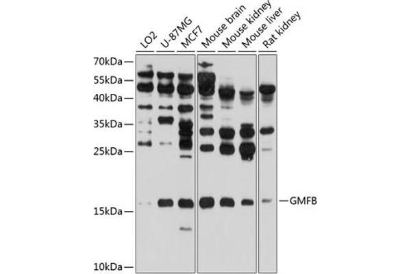 GMFB Antikörper  (AA 1-140)