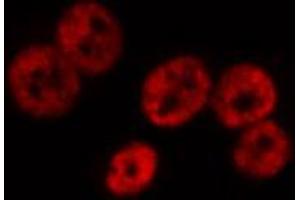 ABIN6267661 staining HeLa by IF/ICC. (SMAD1 antibody  (pSer187))