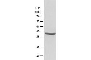 Western Blotting (WB) image for Adenosine Kinase (ADK) (AA 22-362) protein (His tag) (ABIN7286516) (ADK Protein (AA 22-362) (His tag))