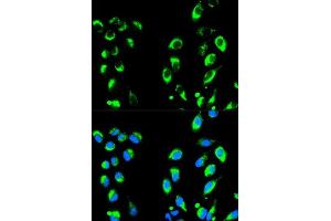 Immunofluorescence (IF) image for anti-Nuclear Factor of kappa Light Polypeptide Gene Enhancer in B-Cells Inhibitor, alpha (NFKBIA) (AA 1-317) antibody (ABIN6144580)