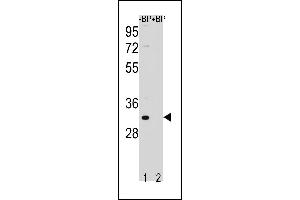 Western blot analysis of FF Antibody (C-term) Pab (ABIN1881333 and ABIN2843243) pre-incubated without(lane 1) and with(lane 2) blocking peptide in NCI- cell line lysate. (FAM26F antibody  (C-Term))