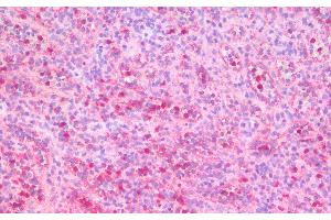 Immunohistochemistry analysis of paraffin-embedded Human Spleen using ITGAX Polyclonal Antibody. (CD11c antibody)