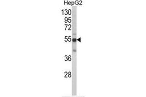 Western blot analysis of CYP2J2 Antibody (N-term) in HepG2 cell line lysates (35ug/lane).