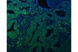 IF analysis of TRMT61A using anti-TRMT61A antibody (ABIN7599220). (TRMT61A antibody  (AA 1-289))