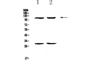 Western blot analysis of CD62P using anti-CD62P antibody .