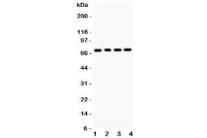 Western blot testing of FOXO1 antibody and Lane 1:  rat lung (FOXO1 antibody  (AA 456-655))