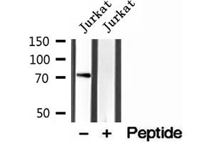 Western blot analysis of extracts of Jurkat cells, using VISA antibody. (MAVS antibody  (C-Term))