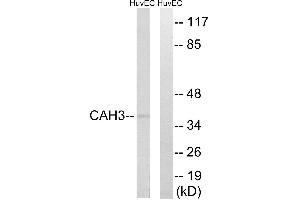 Western blot analysis of extracts from HUVEC cells, using CA3 antibody. (CA3 antibody)