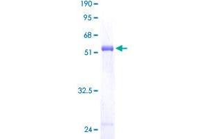 Image no. 1 for Phosphatidylcholine Transfer Protein (PCTP) (AA 1-214) protein (GST tag) (ABIN1314381) (PCTP Protein (AA 1-214) (GST tag))