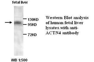 Image no. 1 for anti-Actinin, alpha 4 (ACTN4) antibody (ABIN1574447) (alpha Actinin 4 antibody)