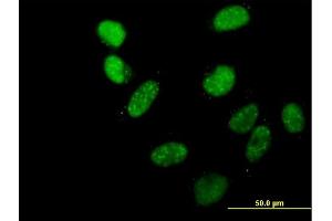 Immunofluorescence of purified MaxPab antibody to C20orf20 on HeLa cell. (MRGBP antibody  (AA 1-204))
