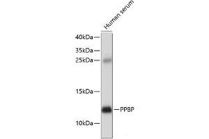 Western blot analysis of extracts of Human serum using PPBP Polyclonal Antibody at dilution of 1:1000. (CXCL7 antibody)