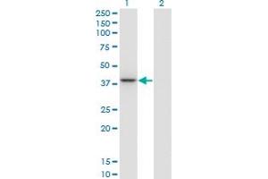 Western Blot analysis of PARVG expression in transfected 293T cell line by PARVG monoclonal antibody (M01A), clone 4E1. (PARVG antibody  (AA 1-331))
