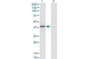 Western Blot analysis of PARVG expression in transfected 293T cell line by PARVG monoclonal antibody (M01A), clone 4E1.