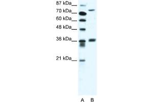 WB Suggested Anti-MID1 Antibody Titration:  2. (MID1 antibody  (C-Term))