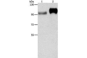 Western Blot analysis of Huvec cell and Human placenta tissue using CD61 Polyclonal Antibody at dilution of 1:500 (Integrin beta 3 antibody)