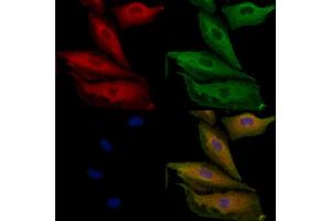 ABIN6264389 and ABIN6279692 staining  cells by IF/ICC. (PPP1R3D antibody  (Internal Region))