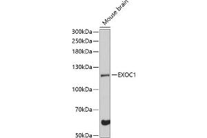 Western blot analysis of extracts of mouse brain, using EXOC1 Antibody (ABIN6129575, ABIN6140361, ABIN6140362 and ABIN6224778) at 1:3000 dilution. (EXOC1 antibody  (AA 645-894))
