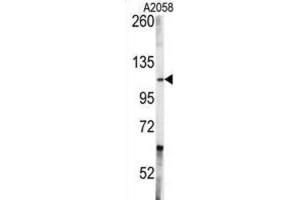 Western Blotting (WB) image for anti-C-Abl Oncogene 1, Non-Receptor tyrosine Kinase (ABL1) antibody (ABIN3003438) (ABL1 antibody)