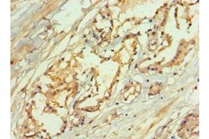 Immunohistochemistry of paraffin-embedded human prostate tissue using ABIN7167072 at dilution of 1:100 (MAPKSP1 antibody  (AA 1-124))