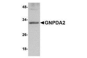 Western blot analysis of GNPDA2 in human kidney lysate with AP30369PU-N GNPDA2 antibody at 1 μg/ml.