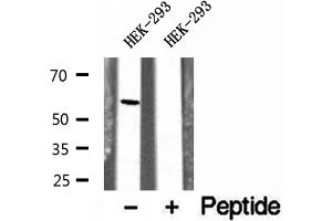 Western blot analysis of extracts of HEK-293 cells, using UGT2B7 antibody. (UGT2B7 antibody)