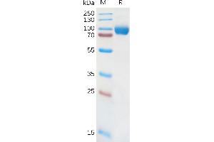 Interleukin 18 Receptor 1 (IL18R1) (AA 19-329) protein (Fc Tag)