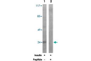 Western blot analysis of extracts from HUVEC cells, treated with Insulin (0. (CEBPE antibody)