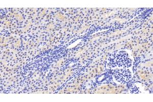 Detection of CASP2 in Human Kidney Tissue using Polyclonal Antibody to Caspase 2 (CASP2) (Caspase 2 antibody  (AA 334-452))