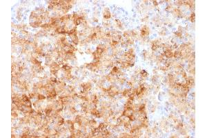 Formalin-fixed, paraffin-embedded human Parathyroid stained with Chromogranin A Rabbit Polyclonal Antibody.