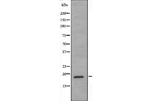 Western blot analysis of extracts from COLO205 cells, using NCBP2 antibody. (NCBP2 antibody  (N-Term))