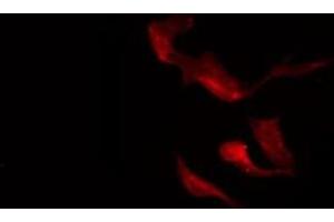 ABIN6275366 staining A549 by IF/ICC. (nectin-3 antibody  (Internal Region))