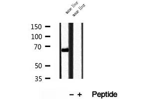 Western blot analysis of extracts of mouse liver tissue, using TOM70 antibody. (TOM70 antibody  (C-Term))