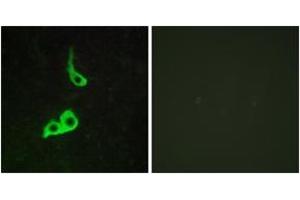 Immunofluorescence analysis of LOVO cells, using GPR153 Antibody. (GPR153 antibody  (AA 195-244))