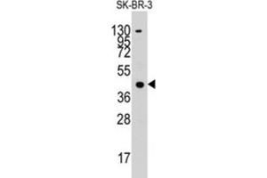 Western Blotting (WB) image for anti-Acetyl-CoA Acetyltransferase 1 (ACAT1) antibody (ABIN3003291) (ACAT1 antibody)