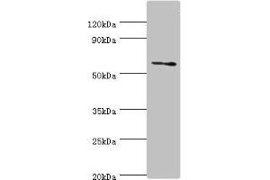 Western blot All lanes: DHCR24 antibody at 2 μg/mL + Jurkat whole cell lysate Secondary Goat polyclonal to rabbit IgG at 1/10000 dilution Predicted band size: 61, 55 kDa Observed band size: 61 kDa (Seladin 1 antibody  (AA 227-516))