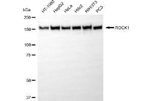 anti-rho-Associated, Coiled-Coil Containing Protein Kinase 1 (ROCK1) antibody